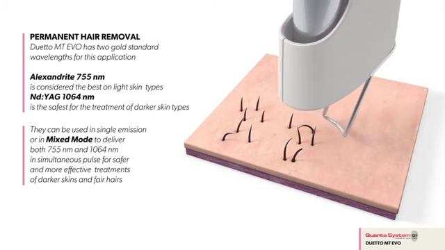 DUETTO MT - QUANTA SYSTEMS