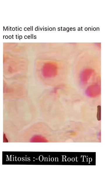 Mitosis:Cell Division.Onion Root Tip Under Microscope 🔬