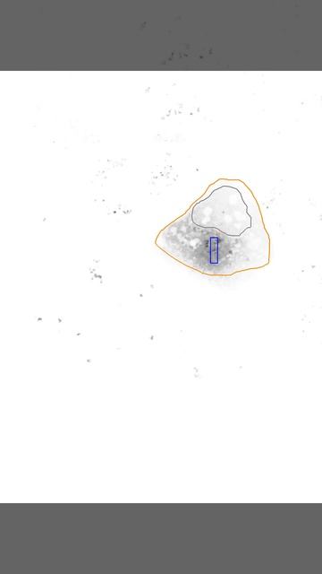 Photoconverting subcellular pools of beta-catenin смотреть онлайн