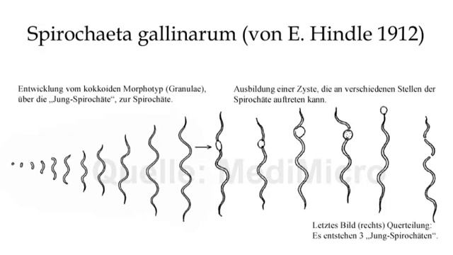 Cystenform der Borrelien / Kugelförmige Spirochäten смотреть онлайн