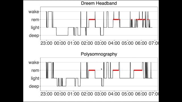 Dreem 2 Headband vs Science (sleep review; short version) смотреть онлайн