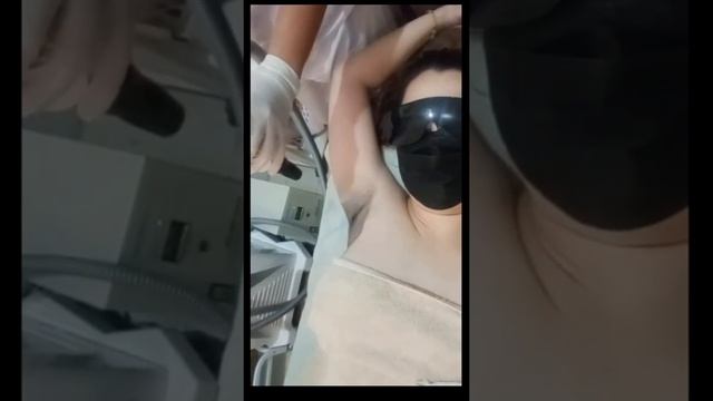 Carbon Laser Underarm Whitening Treatment | Body Care | Life Of MJ