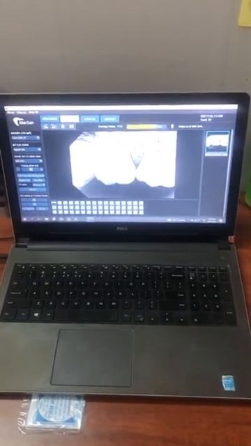 Test XQuang HQY Và Sensor posay смотреть онлайн
