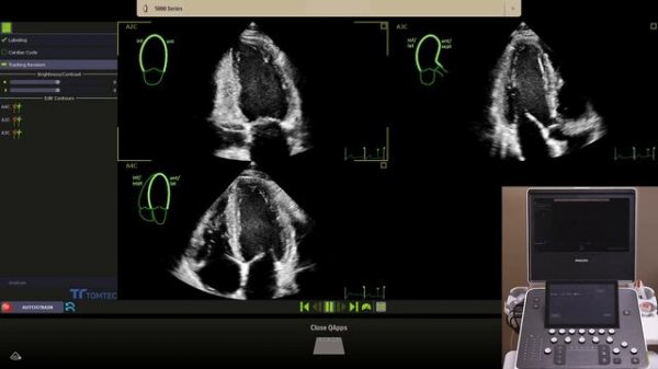 Philips Ultrasound Compact 5000 Point of Care Automation Value Proposition