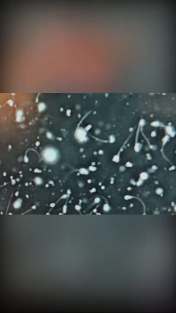 2 dumli spermatozoid смотреть онлайн