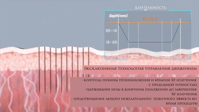 Механизм действия игольчатого RF. Secret по русски