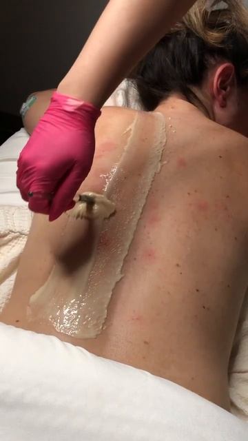 DMK Enzyme Back Treatment #acnetreatment #skin #skincare #esthetician #facial #facialtreatment #acn смотреть онлайн