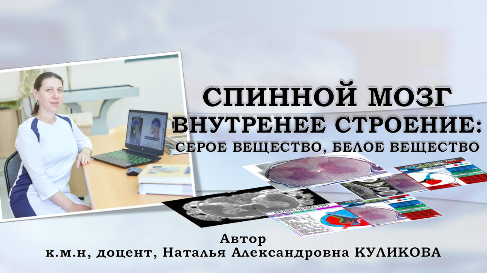 Спинной мозг - внутреннее строение: строение серого и белого вещества смотреть онлайн