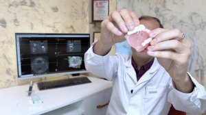 Как ухаживать за деснами (швами) после имплантации?