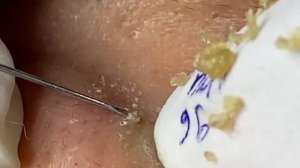 Enjoy Every Day With The Best Video Loan Nguyen Spa Official  2338