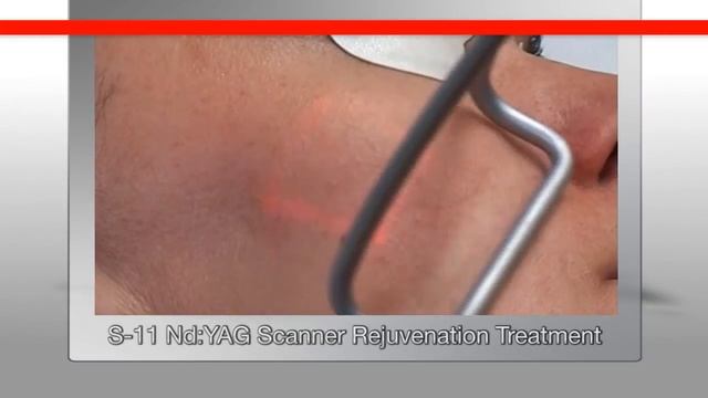 Fotona aesthetics procedures offered at the Instant Laser Clinic смотреть онлайн