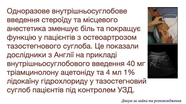 Ця ін'єкція стероїду і анестетика покращує функцію тазостегнового суглоба при остеоартрозі