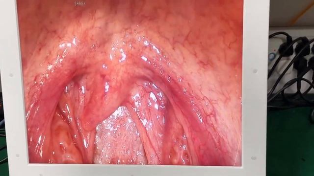Multi use Led Light Medical Endoscope Camera All In One AC-GW605 смотреть онлайн