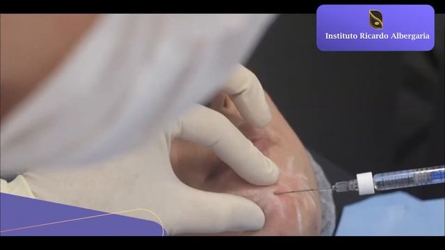 EPTQ 500 MENTO смотреть онлайн
