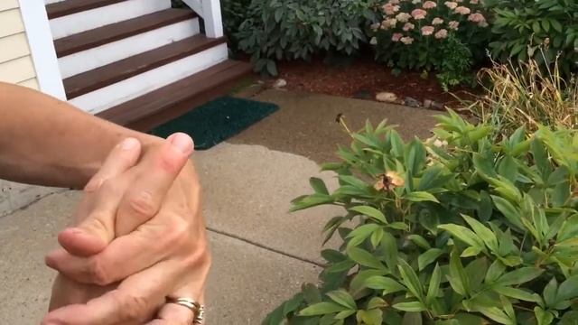 How To Remove A Bee Stinger смотреть онлайн