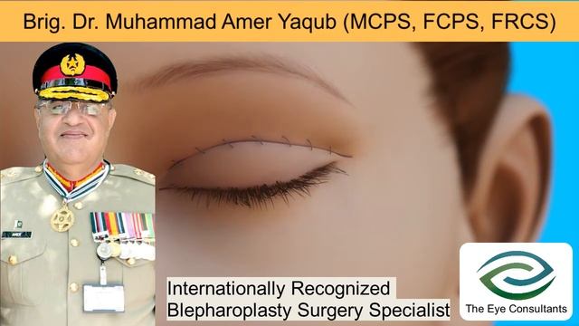 Best Oculoplastic Surgeon In Pakistan | Brig. Dr. Muhammad Amer Yaqub | The Eye Consultants