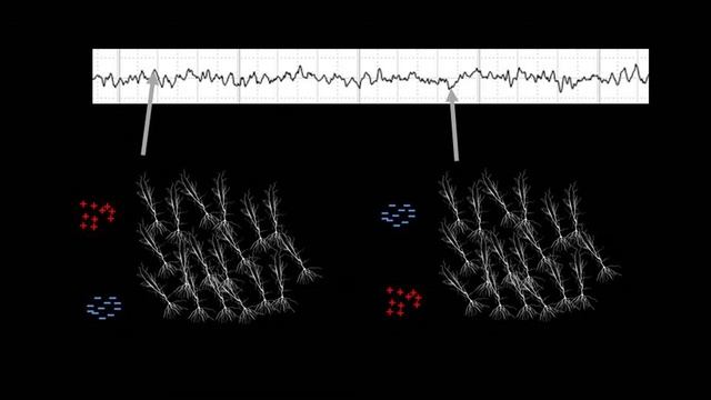 Electroencephalography (EEG) Explained | Neuroscience Methods 101
