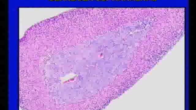 Morfofisiologia humana 3, Video 7 8 y 9 (MEDICINA INTEGRAL COMUNITARIA, MIC VENEZUELA) смотреть онлайн