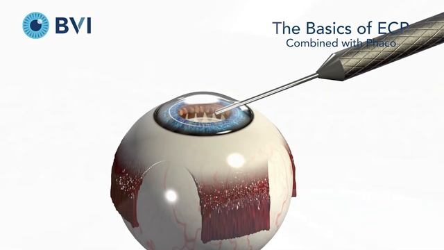Endo Optiks - Basic ECP BVI2019 1520641 01 r05a смотреть онлайн