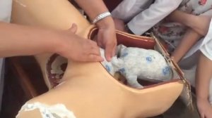 Симптом Вастена в акушерстве