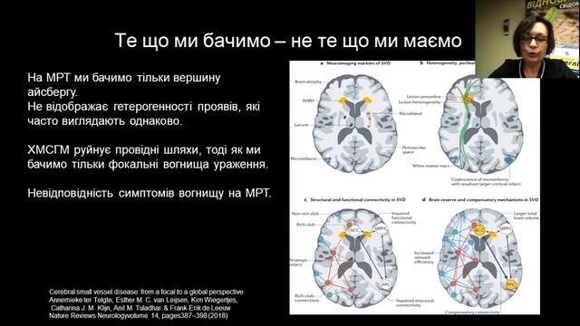 Судинні когнітивні порушення смотреть онлайн