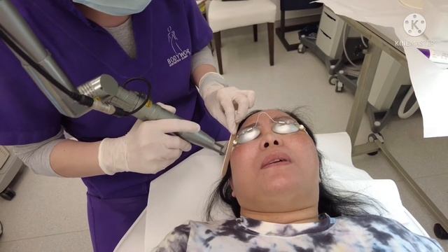 LASER TREATMENT FOR MELASMA DARK SPOTS HYPERPIGMENTATION AT SNO BODYWORX DERMATOLOGY CLINIC смотреть онлайн