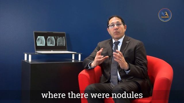 Clinical trial tests the effectiveness of the Reveal™ X-ray detector in patients with lung cancer смотреть онлайн