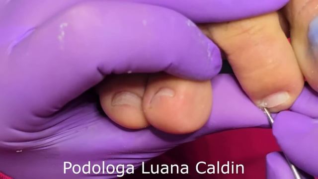 Podologa Luana Caldin смотреть онлайн