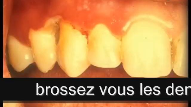 UFSBD смотреть онлайн