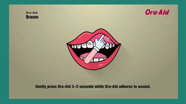 Ora Aid, o penso intraoral que promove a rápida recuperação após cirurgia. Saiba mais www.biofix.pt смотреть онлайн