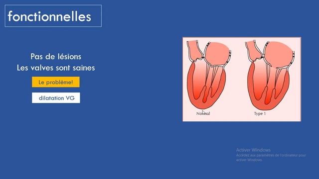 insuffisance mitrale 04 dans 20 min comprenez tous à propos des étiologies de l'insuffisance mitral смотреть онлайн