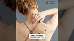 Удаление родинок