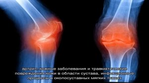 Рентгенография суставов