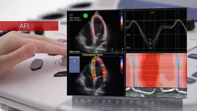 Vivid T8 смотреть онлайн