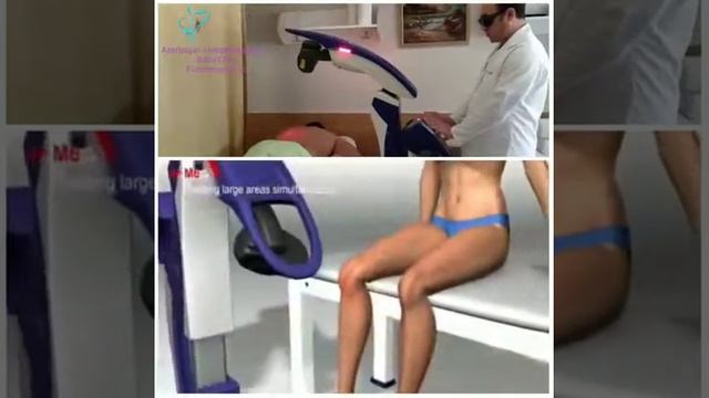 AZƏRBAYCANDA ILK ~ YALNIZ BIZIM ŞÖBƏDƏ! AĞRI VƏ ACILARA ASSA LASER M6 APARATIYLA SON смотреть онлайн