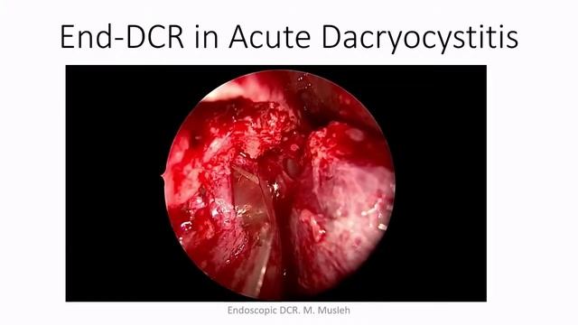 بث مباشر 3/المؤتمر العلمي الرابع/ لاطباء الاذن و الانف و الحنجره смотреть онлайн