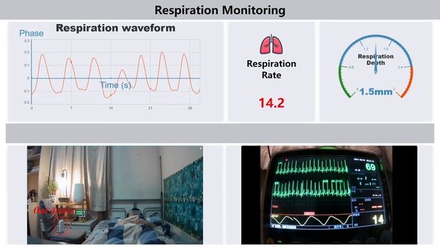 Fine-grained Respiration Monitoring During Overnight Sleep Using IR-UWB Radar смотреть онлайн