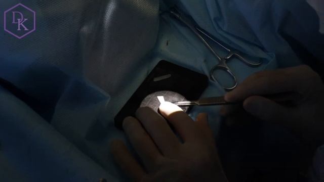 Ринопластика делает Мухтар Сарсембиевич смотреть онлайн