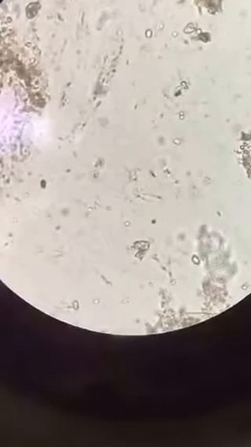 Análisis de agua estancada vista desde el microscopio óptico смотреть онлайн