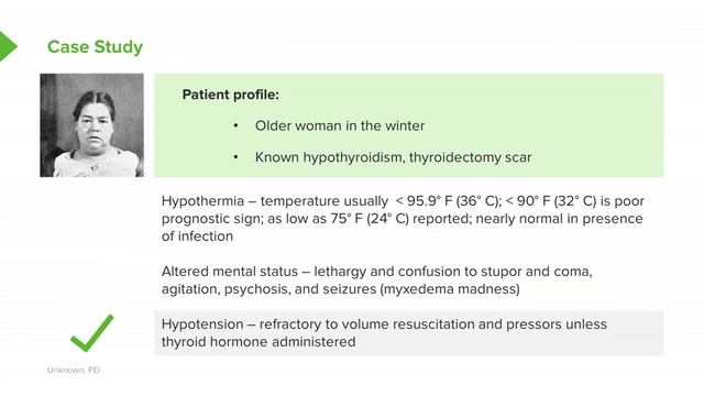 10 Hypothyroidism- Symptoms, Diagnosis & Treatment