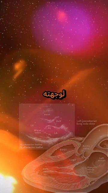 Valvular Diseases #Anatomy #Valves #Stenosis #Regurgitations смотреть онлайн