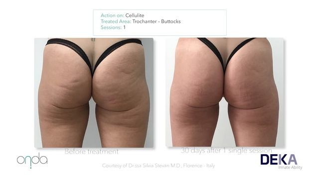 Onda Clinical Cases Slide Show смотреть онлайн