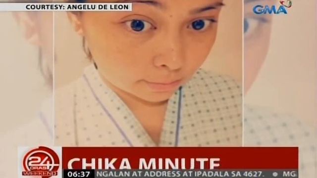 24 Oras: Angelu de Leon, ipinakita ang epekto ng bell's palsy sa kanyang mukha смотреть онлайн