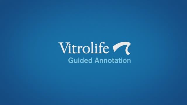 Интеллектуальная обработка данных с Guided Annotation смотреть онлайн