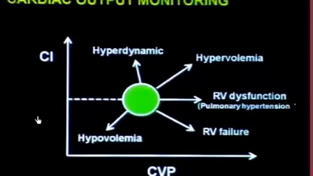 21  Pulmonary artery cather  Vinsent J L (2009)
