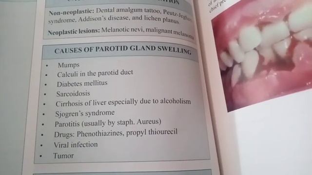 What are oral ulcers and its causes Must watch смотреть онлайн