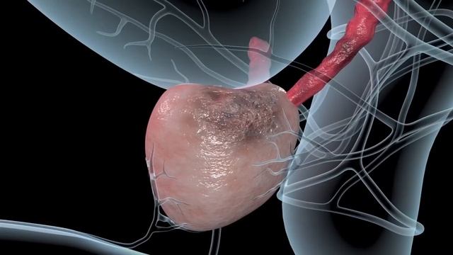 Top 10 Natural Herbs To SHRINK An Enlarged Prostate | Number 3 Will Surprise You