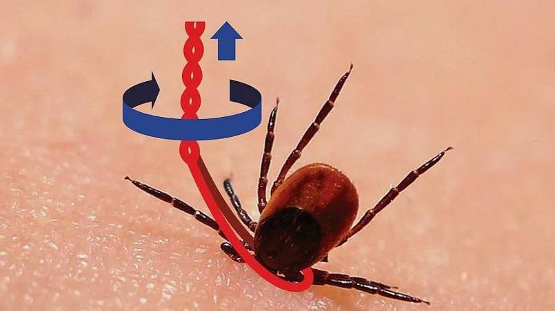 Как удалить клеща? ЛУЧШИЙ способ удаления клеща!