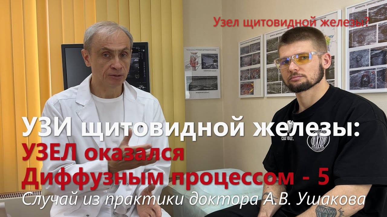 УЗИ щитовидной железы: Как узисты приняли сегмент за Узел // Доктор Ушаков