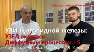 УЗИ щитовидной железы: Как узисты приняли сегмент за Узел // Доктор Ушаков